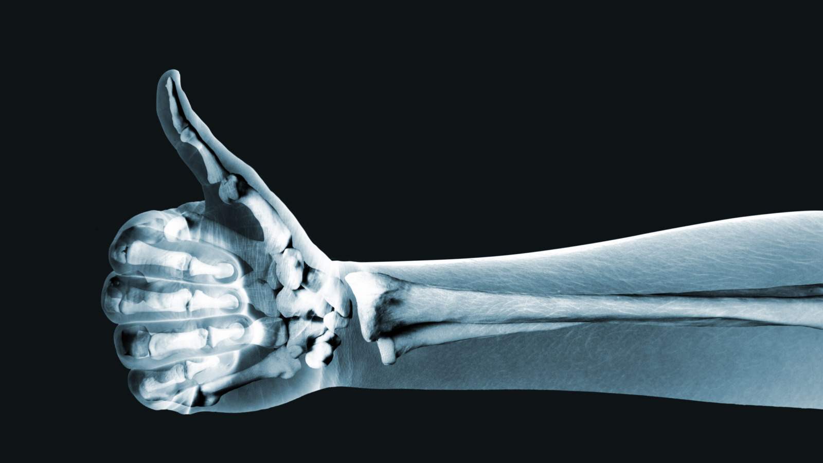 X-ray of a hand giving a thumbs-up